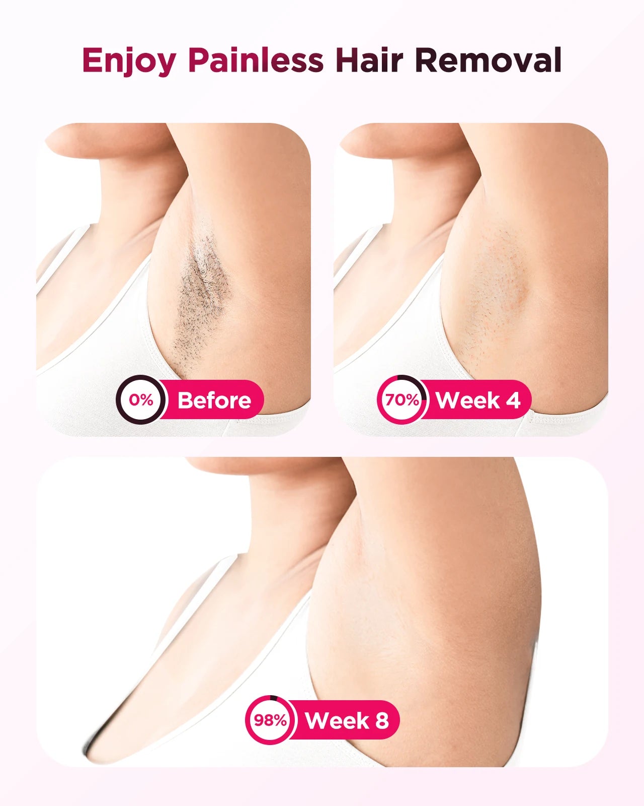 FlashPro IPL Hair Remover