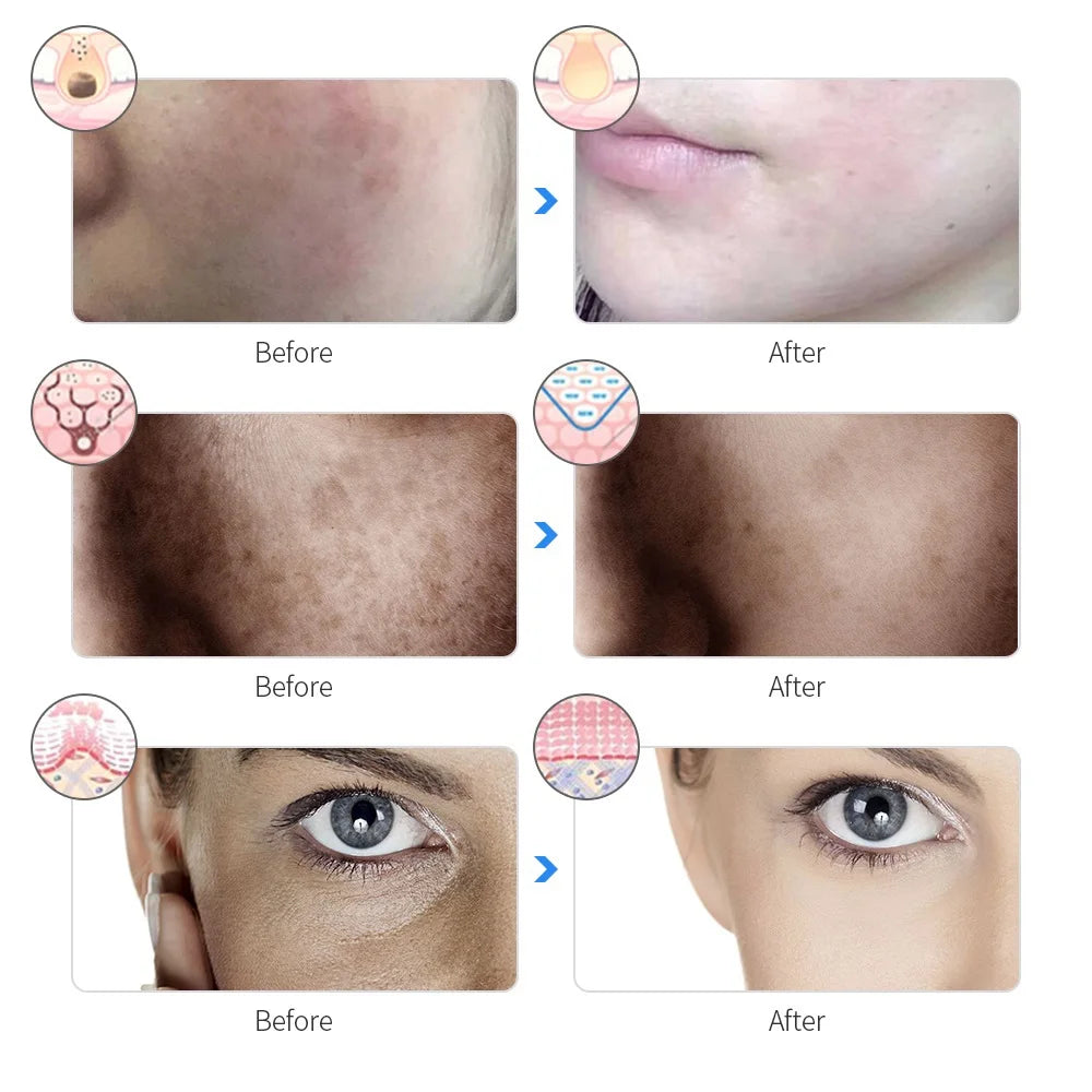 Photon Glow Facial Mask